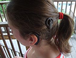 cochlear implant outer